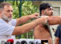 احتجاج کے دوران زخمی طالب علم کو میڈیا کے سامنے لائے راہل