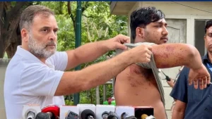 احتجاج کے دوران زخمی طالب علم کو میڈیا کے سامنے لائے راہل