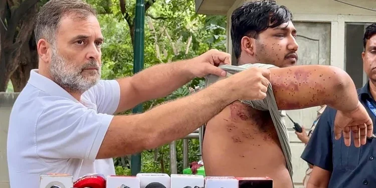 احتجاج کے دوران زخمی طالب علم کو میڈیا کے سامنے لائے راہل